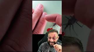 Download lagu Bite from the barber bug, a triatomine bug that transmits Chagas disease mp3