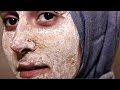 This Beauty Vlogger tried Bird Poop as a Face Mask! Watch to See her Results