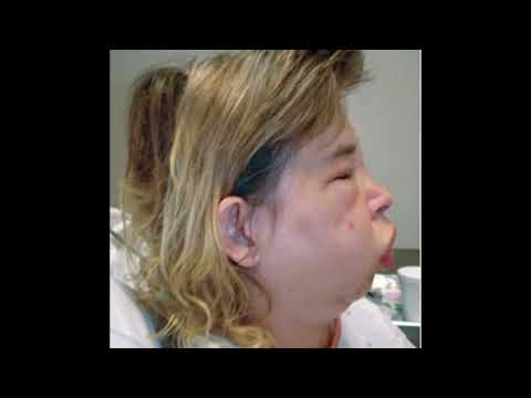 MED SURG -- CHAPTER 18