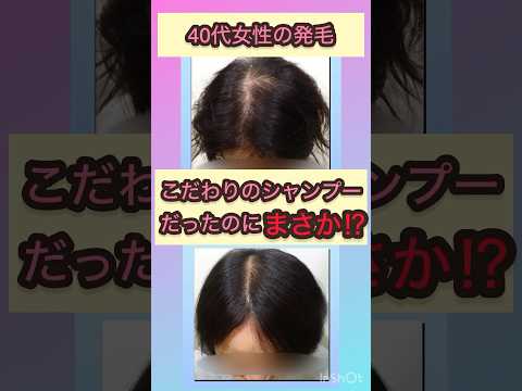 髪を正しく洗いましょう: 1 つの方法だけを避けてください – 抜け毛につながる可能性があります