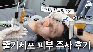 피부과 원장의 줄기세포 주사 브이로그