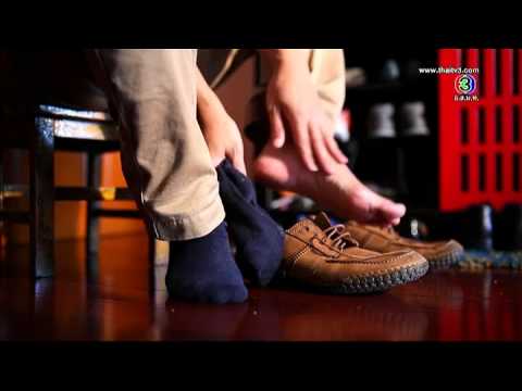 เท้าเหม็น