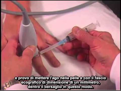 Se toracica influenza osteocondrosi sul cuore Mal di schiena durante la gravidanza 21 settimane che