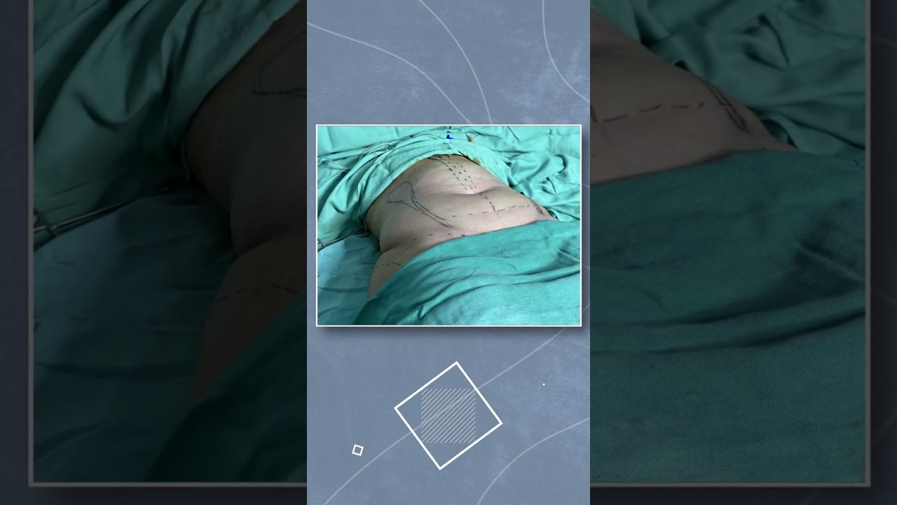 أفضل نتائج لنحت الجسم