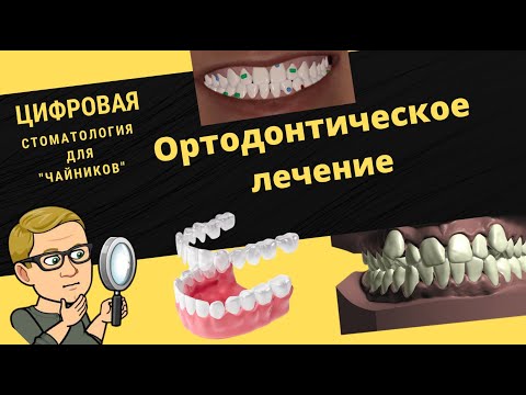 Цифровая стоматология для чайников. 6 серия. Ортодонтическое лечение.