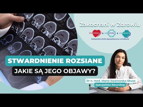 Objawy STWARDNIENIA ROZSIANEGO | Zakochani w Zdrowiu