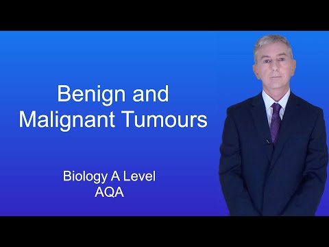 A Level Biology Revision (Year 13) "Benign and Malignant Tumours"