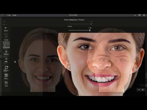 DTS PRO: Smile Design Software powered by Artificial intelligence