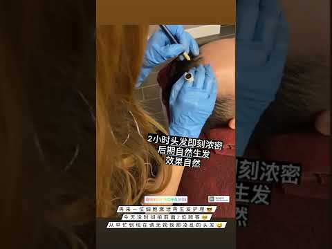 Sense Of Touch Hair Loss Treatment Testimony / 面对脱发问题 & 生发护理