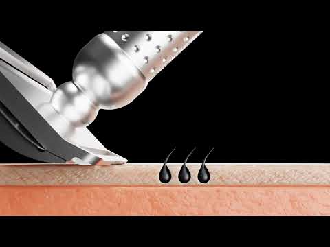 What are the differences between a closed comb and open comb safety razor?