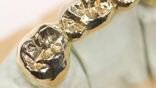 Gold Grills Are NOT Just For Flava Flav!
