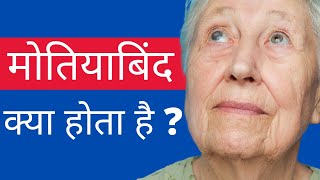 What is Cataract? | Its Symptoms, Treatment and Surgery | मोतियाबिंद के लक्षण, उपचार और सर्जरी