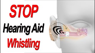 8 Steps to Stop Hearing Aid Whistling or Warbling Due to Feedback