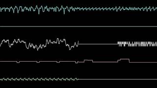 [XQ] Pokémon FireRed/LeafGreen: Trainer Battle