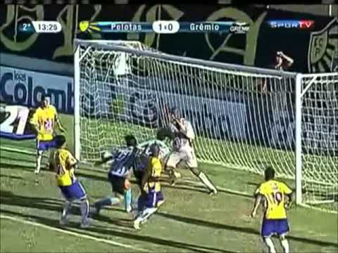 MBG Analisa - Pelotas 1 x 0 Grêmio