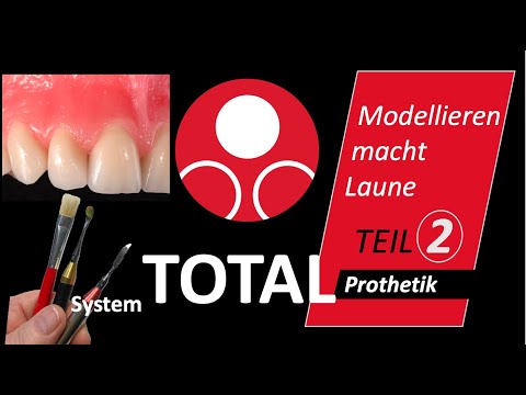 Die Zahnfleischmodellation-Teil 2  - Gut geeignet für Gehörlose - #KallemachtProthesen