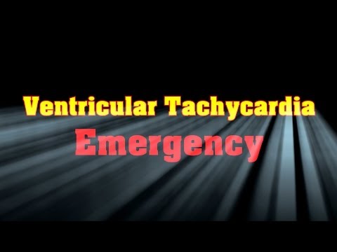 Ventricular Tachycardia Emergency