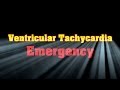 Ventricular Tachycardia Emergency