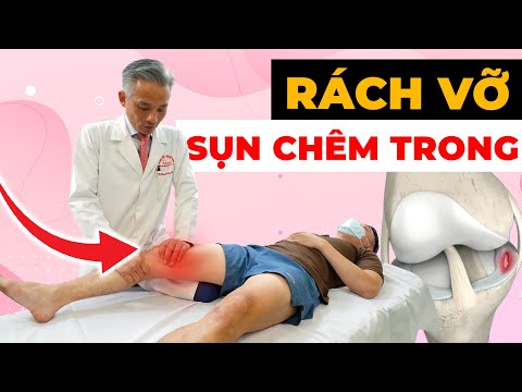 Đừng Để Sụn Chêm Trong Rách Hủy Hoại Cuộc Sống - Giải Pháp Xử Lý Hiệu Quả