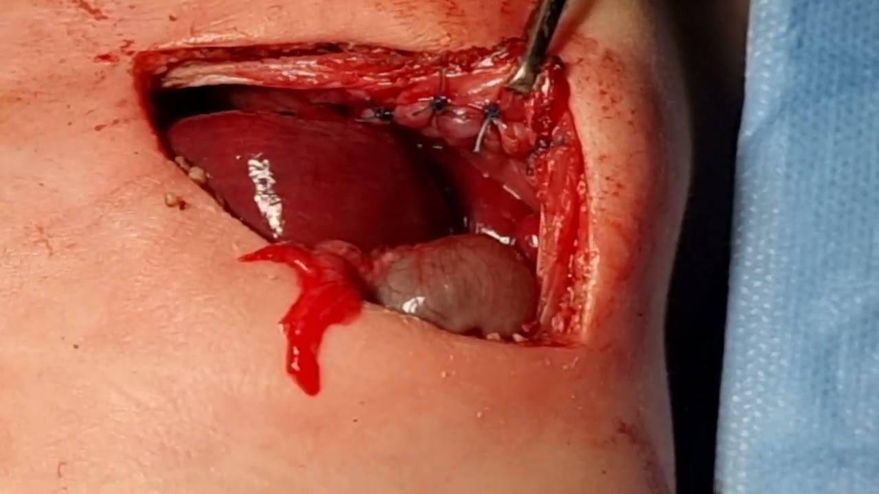 Agustin Bejar Martinez-18