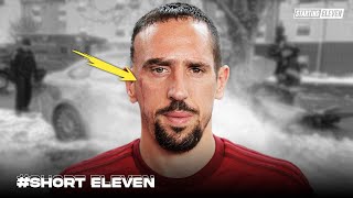 Kisah Pilu Franck Ribery di Balik Bekas Luka di Wajahnya