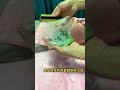Satisfying Aloe Vera Hacks Amazing Benefits Of Aloe Vera 23