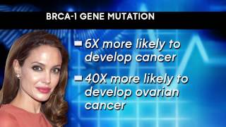 Ovarian Cancer Preventative Surgery Options