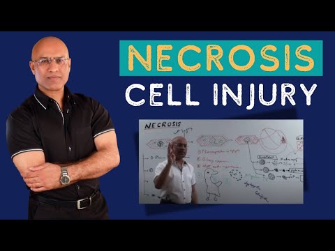 Necrosis Cell Injury | Apoptosis | General Pathology🦠
