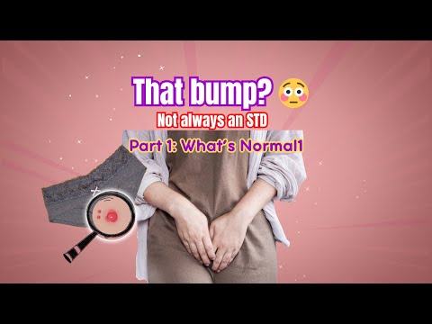 Vulva Pimple? What It Actually Means