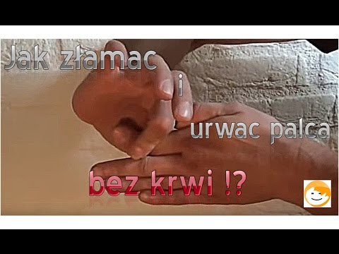Kot na opuszkach palców od wzrostów łapy Koślawego pro korektor Kup