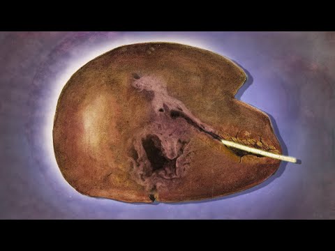 YouTube video about: Does lemon juice dissolve fish bones?