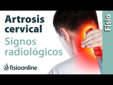 Esercizi, sporgenza del disco intervertebrale toracico Lo sporco con osteoartrite del ginocchio