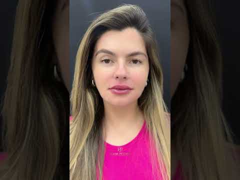 Resultado de Tratamento Video 1