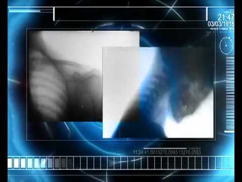 Erofex - Science Fiction - VJ Cosmic Monkey Video Clip