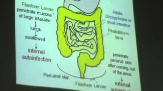 Dr Azza 11 25 11 2014   Part 1   YouTube