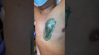 Download lagu Professional male chest wax using hard wax from Nacach #waxing #estheticianlife #esthetician mp3 Download lagu Professional male chest wax using hard wax from Nacach #waxing #estheticianlife #esthetician mp3