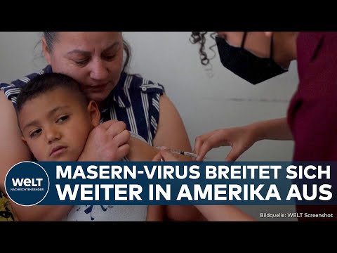 MASERN-AUSBRUCH: Hunderte Kinder infiziert! Virus breitet sich von Nordamerika nach Mexiko aus