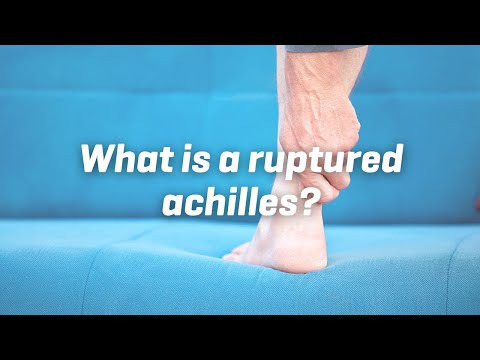 Self-Diagnosing a Ruptured Achilles: Essential Steps & Precautions