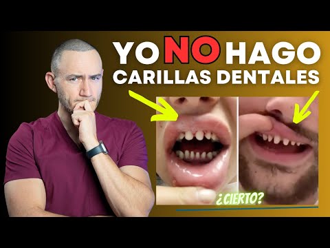 YO NO HAGO CARILLAS DENTALES