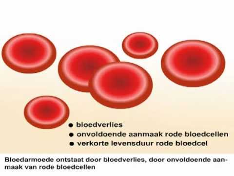 Bloedarmoede - Wat is bloedarmoede en wat zijn de symptomen?
