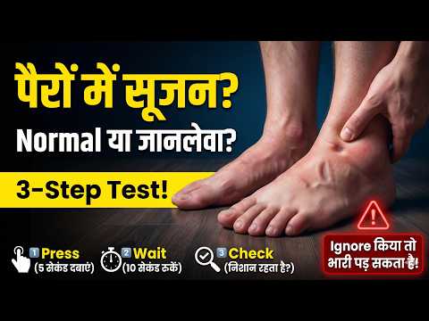 पैरों की सूजन का 3-स्टेप टेस्ट: क्या यह सामान्य है या खतरनाक?