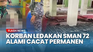 UPDATE Kondisi Korban Ledakan SMAN 72 Jakarta, Alami Pecah Gendang Telinga hingga Jari Diamputasi