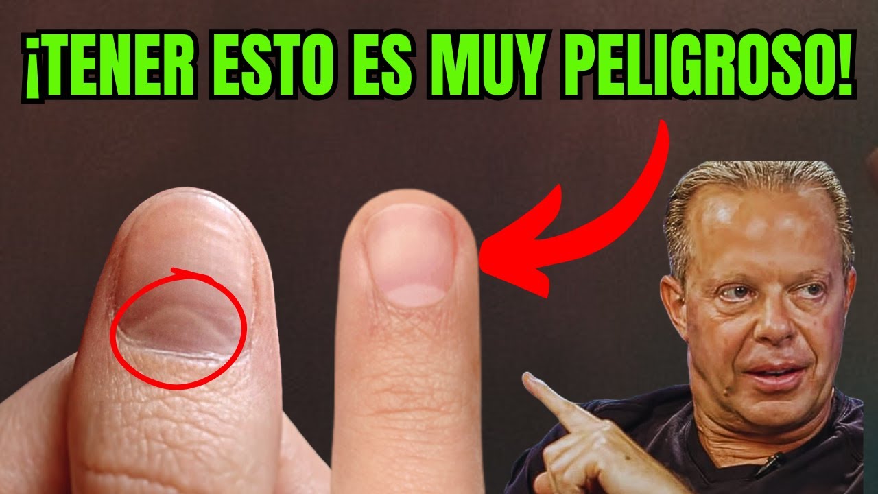Nostradamus reveló que quienes tienen una luna creciente en el pulgar y una M en la mano serán...