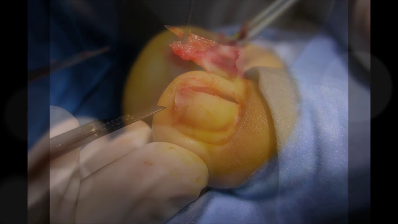 Joan Lozano Freixas-22