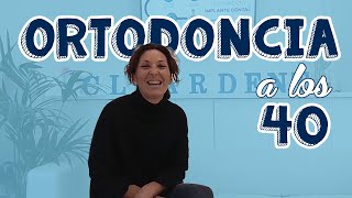 ¿Ortodoncia a los 40? - Cleardent Jaén