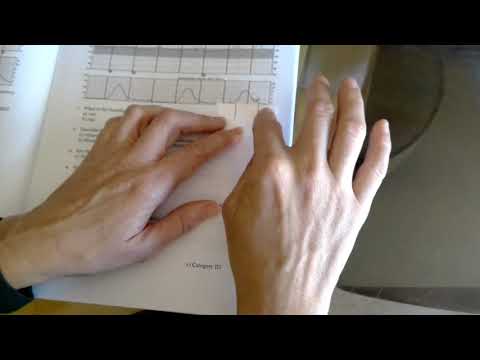 Learning to measure duration and frequency of contractions