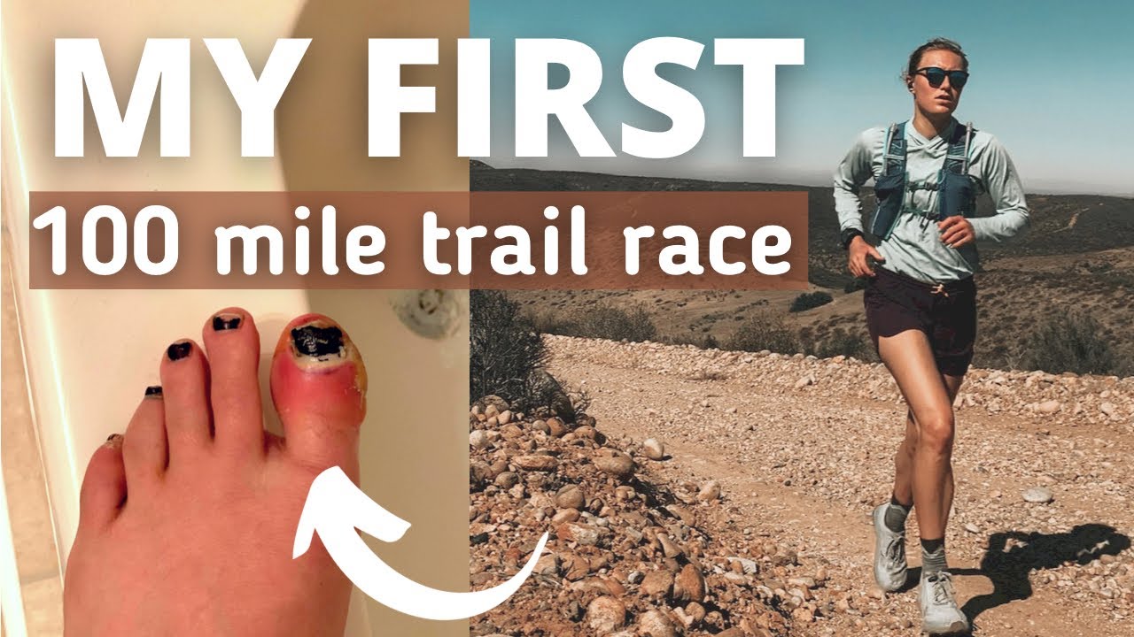 Uwharrie 100 Miler w/ an INJURY! | 36 hour cutoff | 17,500 ft | 102.5 miles