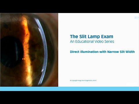 The Slit Lamp Exam – Episode 3, Direct Illumination with Narrow Slit Width