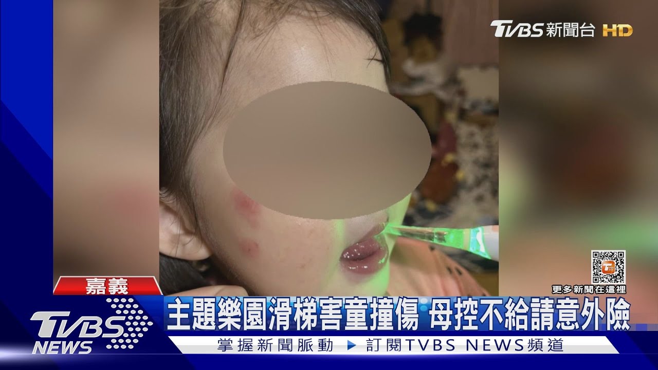 童玩滑梯撞傷眼!母控「不理賠」 飯店業者:同仁表達有誤會