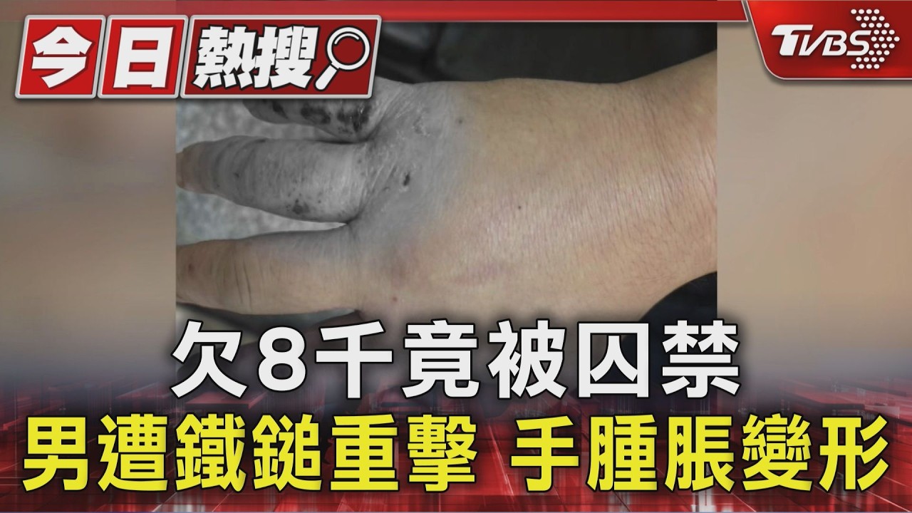 欠8千竟被囚禁 男遭鐵鎚重擊 手腫脹變形|TVBS新聞 @TVBSNEWS01